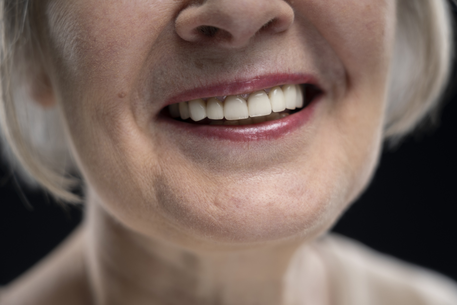 Araucária passa a oferecer prótese dentária gratuita pelo SUS pela primeira vez